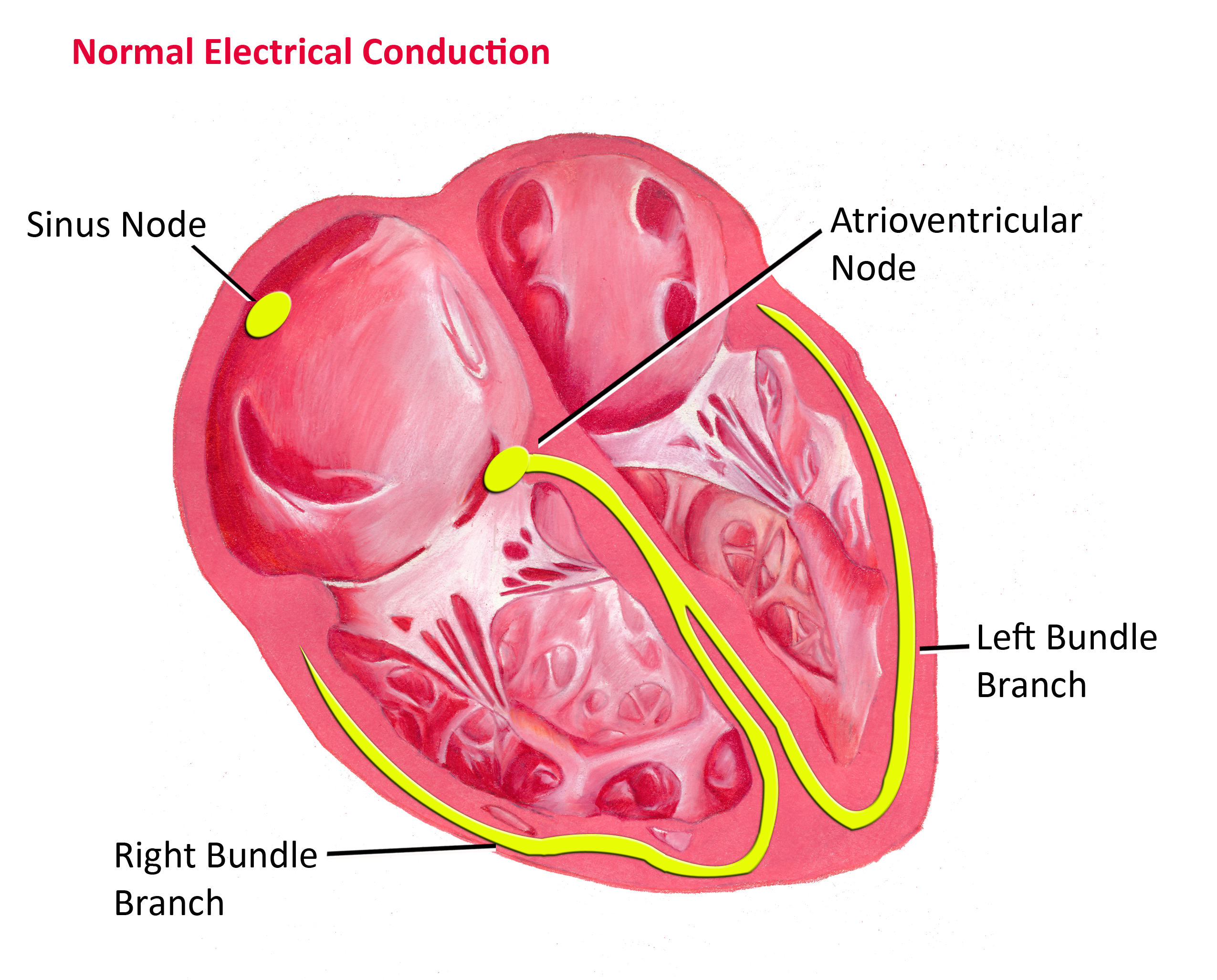 Normal Electrical Conduction